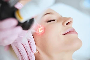 Laser Skin Treatment